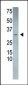 Calcipressin 3 (DSCR1L2) Antibody (N-term)
